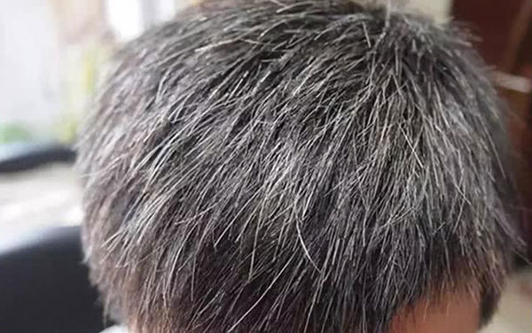 ��ͷ����ô��� �������ͷ��������